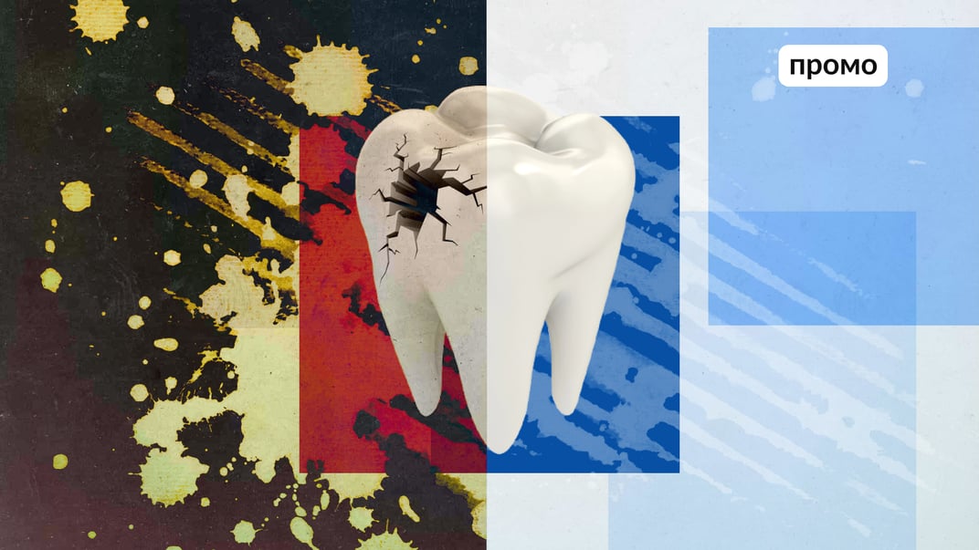 Ця їжа руйнує зуби: приховані загрози в щоденному раціоні