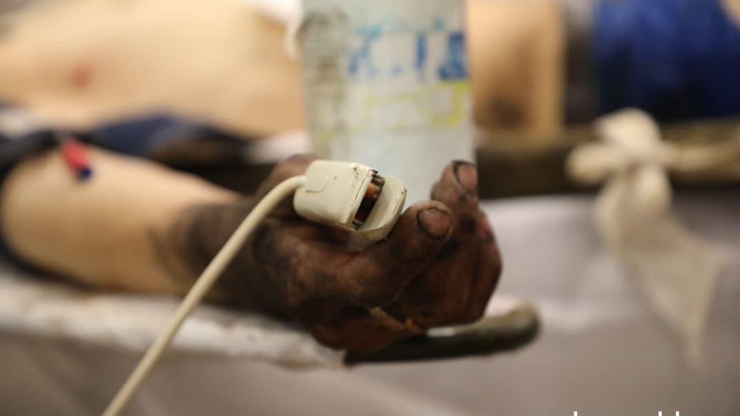 На чорній, мов сажа, руці непритомного бійця — датчик кров’яного тиску