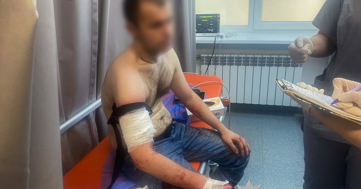 У Запоріжжі чоловік напав з ножем на правоохоронців, коли у 