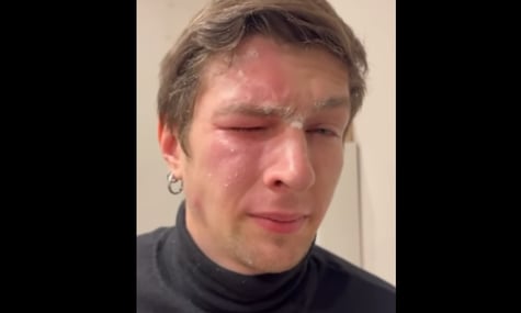 У Львові жінка розпилила перцевий балончик в обличчя сусіду-ветерану через сварку