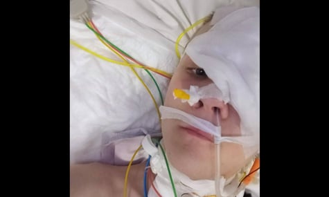 Підхопив застуду, а через тиждень «витягали з того світу». Львівські медики врятували підлітка з гноєм у мозку