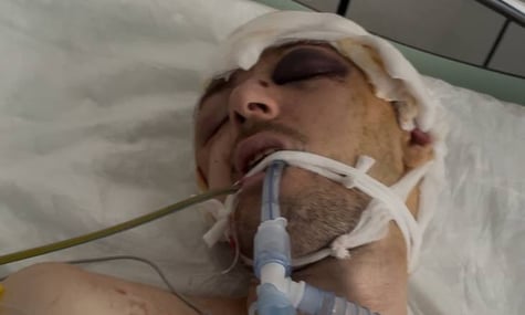 На Львівщині мобілізований чоловік вистрибнув із кузова автівки, коли його везли на полігон — поліція