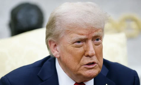 У Трампа виявили хронічну хворобу. Він проходив медобстеження через набряки та синці