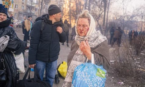 С начала войны в Киеве погибли 222 человека, 889 ранены