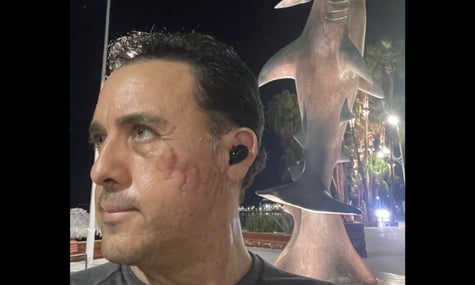 Мексиканський біолог Маурісіо Ойос, який вижив після нападу акули