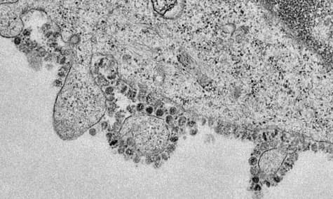 Ученые показали снимки размножения нового коронавируса