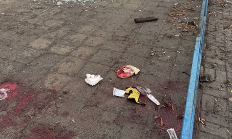 Окупанти атакували адмінбудівлю у Сумах: постраждав підліток