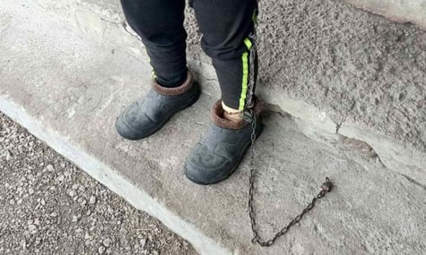 На Кіровоградщині дівчинку з інвалідністю тримали в ланцюгах у дитбудинку сімейного типу — слідство