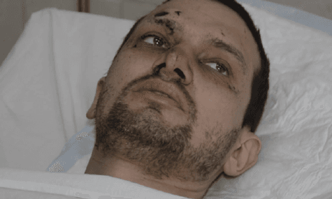 Injured Doctor Survived Three Days In Freezing Cold On East Ukraine Frontline