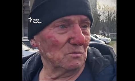 Сів в охоплений вогнем автомобіль і поїхав: у Києві чоловік рятував машини після обстрілу