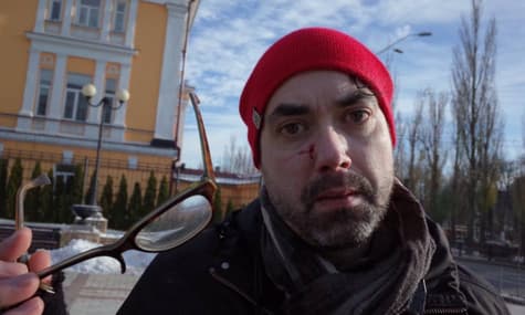 Радикали побили іноземного журналіста на марші пам’яті трансгендерних людей у Києві