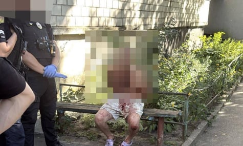 У Білій Церкві чоловік убив ножем неповнолітню сестру. Його затримали