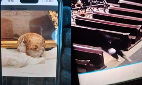 Фото викраденого черепа та підозрюваного у крадіжці