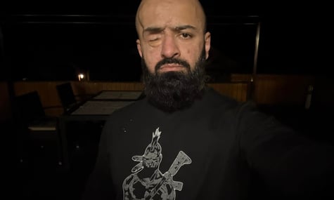 Військовий Найєм, який втратив око, не зміг створити monоКЕП, бо там треба кліпнути. У банку відповіли