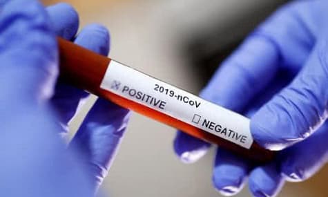 Ukraine's Count of Coronavirus Infections Doubles to 14