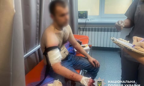 У Запоріжжі застрелили чоловіка, який напав із ножем на правоохоронців