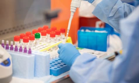 За добу коронавірус в Україні виявили у 468 людей