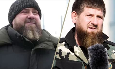 Bild: кадиров серйозно хворий, до нього прилетів лікар з ОАЕ