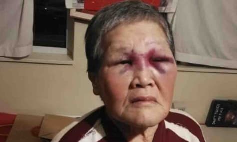 76-летняя китаянка дала отпор 39-летнему мужчине, напавшему на нее. В соцсетях восхищены смелостью бабушки