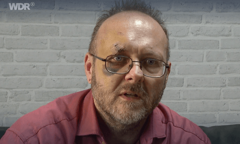 Називали «лівим щуром» та «зрадником». У Німеччині побили колишнього політика АдН, який вийшов із партії