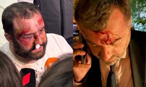 У Мін'юсті Грузії припустили, що за побиттям протестувальників стоять самі організатори протесту