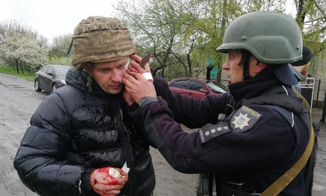 На Дніпропетровщині чоловік кинув у бік поліції гранату. П’ятеро поранених осколками