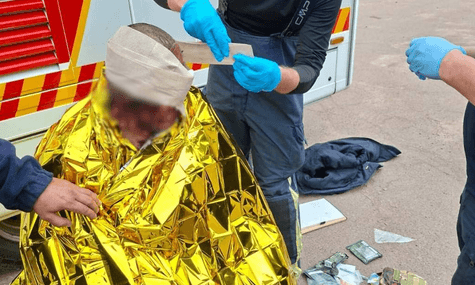 На Житомирщині росіяни атакували агропідприємство. Серед постраждалих — троє дітей