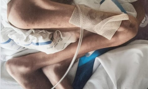 Важив лише 14 кілограмів. У Чернівцях судитимуть матір, чий 11-річний син із ДЦП помер від виснаження