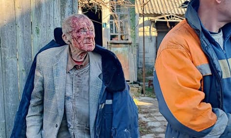россияне обстреляли Казачью Лопань в Харьковской области: три человека ранены