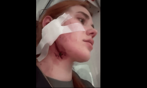 «Розірвали вухо, вдарили електрошокером». Родина українців заявила про напад у Вроцлаві через їхній акцент