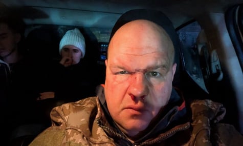 На Тернопільщині перевіряють, чи «підполковник ТЦК» справді погрожував військовому, якого побили дорогою з відпустки