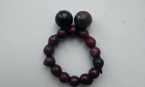 В Івано-Франківську медики врятували семирічного хлопчика, який проковтнув 17 магнітів