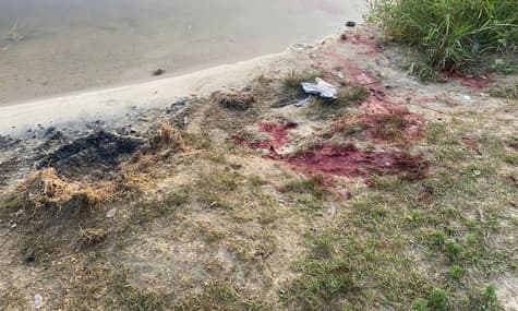Возросло количество пострадавших в результате атаки россиян на Константиновку
