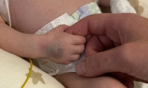 Син породіллі, що загинула через обстріл, вважається сиротою, маючи живого батька. Питання розв’яже суд