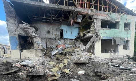 У хлопчика з Дніпропетровщини, якого помилково назвали загиблим, уже покращився стан. Його перевели з реанімації