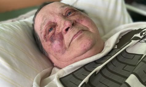 Оккупанты сломали позвоночник 75-летней женщине из Херсона, которая не хотела отдавать украинский паспорт