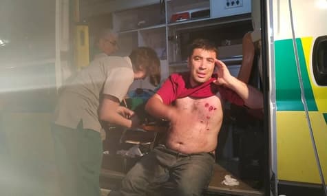 У Тбілісі поліція застосувала сльозогінний газ проти мітингарів, є постраждалі