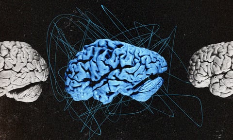 Війна і деменція. Забуваєте назви предметів чи бʼєтеся об одвірки — це вже сигнал, що треба до невролога?