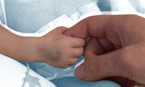 Сирота з живим батьком. Історія Назарчика, який народився після обстрілу Києва