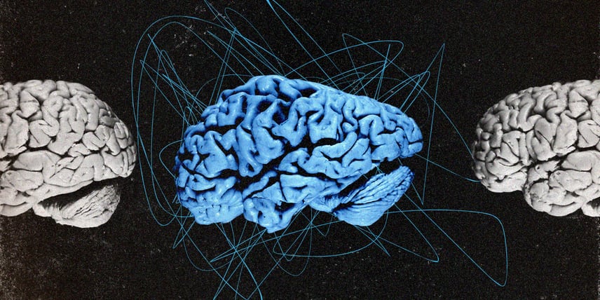 Війна і деменція. Забуваєте назви предметів чи бʼєтеся об одвірки — це вже сигнал, що треба до невролога?