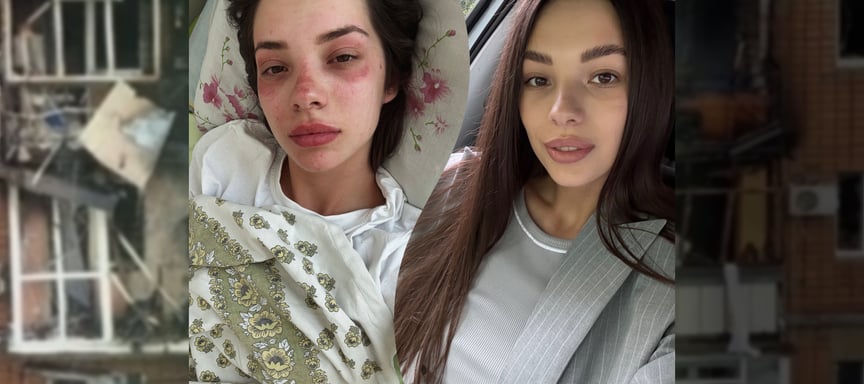 Выживает один из ста. Что пострадавшие и спасатели говорят о пребывании людей под завалами
