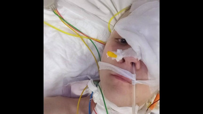 Львівські медики врятували 16-річного хлопця, який впав у кому з масивним скупченням гною в мозку