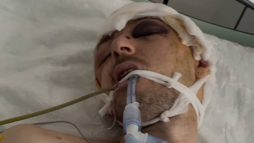 Мобілізований чоловік після того, як вистрибнув з кузова вантажівки