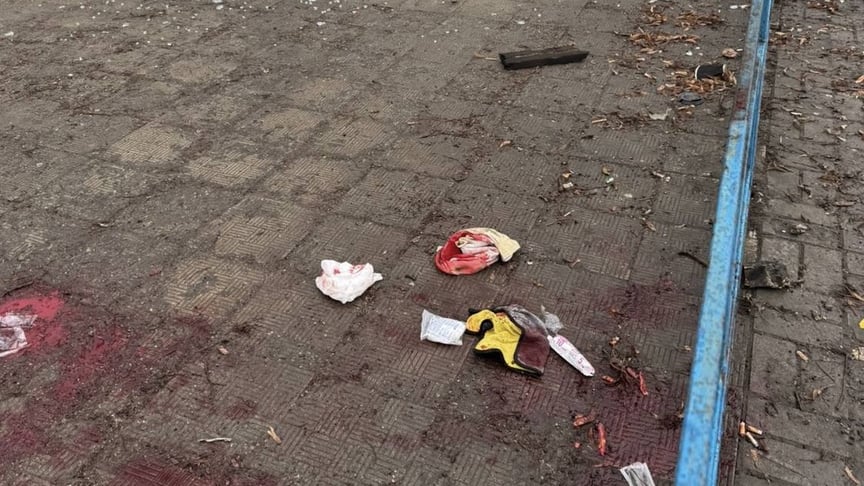 Окупанти атакували адмінбудівлю в Сумах: постраждав підліток