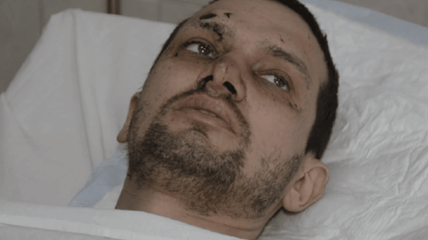 Injured Doctor Survived Three Days In Freezing Cold On East Ukraine Frontline
