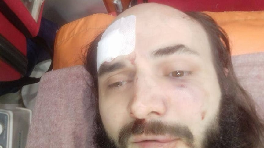 Священник Віталій Гончарюк, про поранення якого в Чернівцях заявила єпархія УПЦ Священник Віталій Гончарюк, про поранення якого в Чернівцях заявила єпархія УПЦ