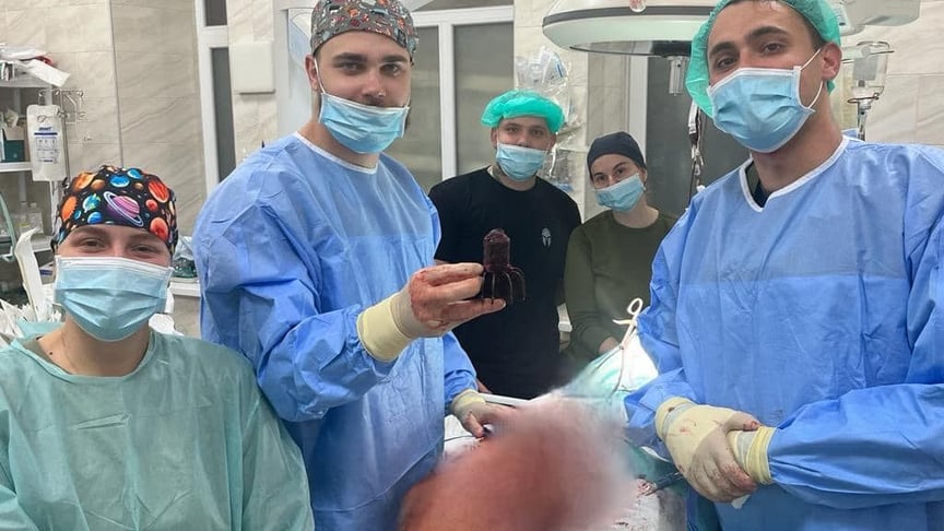 Хвостовик міни, який дістали з тіла пораненого військового