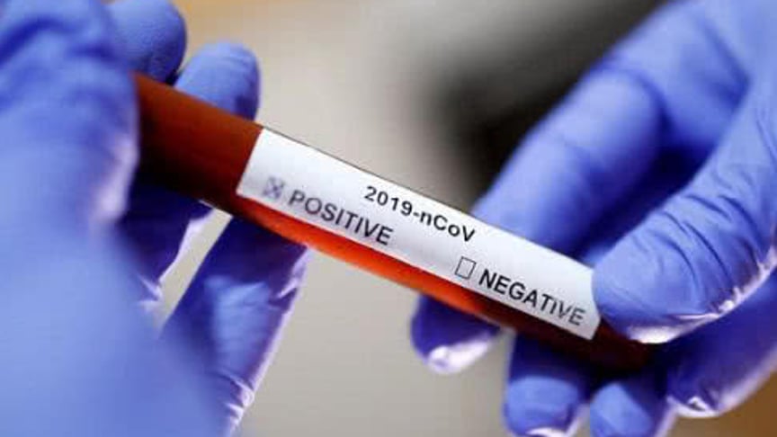 Ukraine's Count of Coronavirus Infections Doubles to 14
