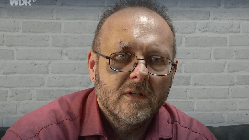 Райнер Тюшенбьоннер після побиття