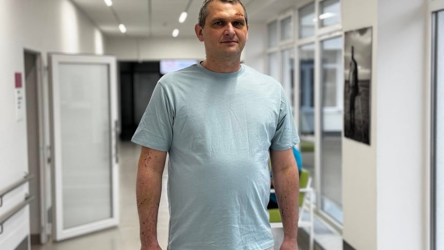 Постраждалий львів’янин Юрій Пиріг, з легені якого витягли 10-сантиметровий шматок скла